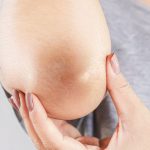 Dark knees and elbows home remedies