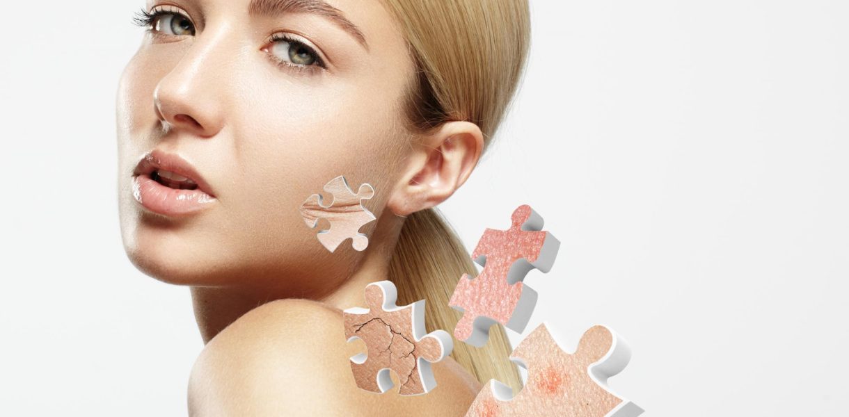 Acne Face Mapping: Your Secret To Radiant Complexion!