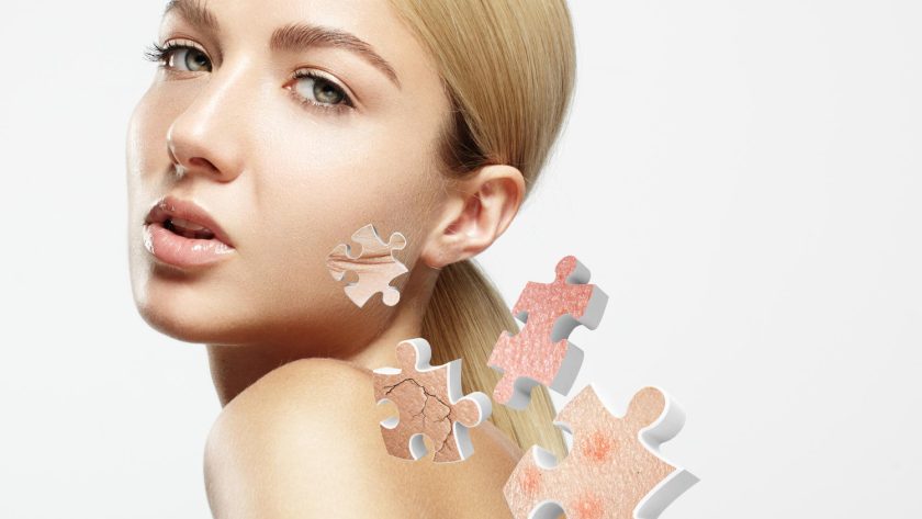 Acne Face Mapping: Your Secret To Radiant Complexion!