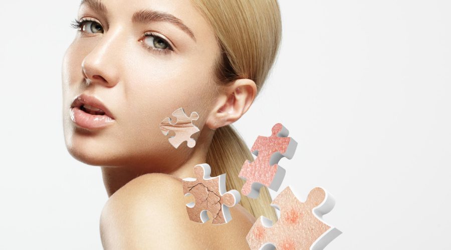 Acne Face Mapping: Your Secret To Radiant Complexion!